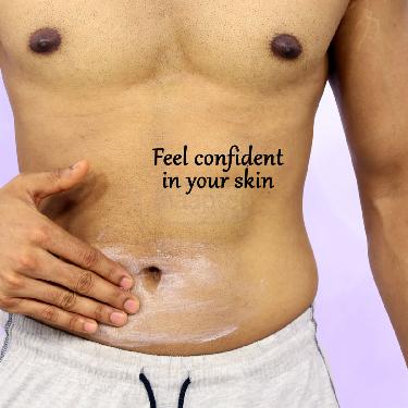 Stretch Marks Repair Cream (SMRC2)