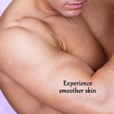 Stretch Marks Repair Cream (SMRC2)