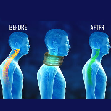 Cervical Neck Support for Pain Relief (PRS45)
