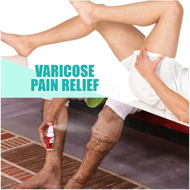 Varicose Pain Relief Spray B1G1 (PRS74)