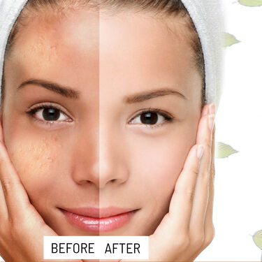 Vitamin C Face Care Combo