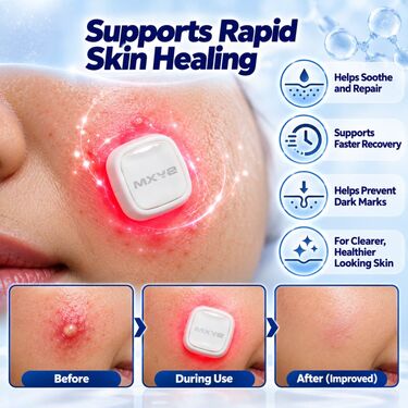 Pack 6 Electronic Acne Patches (PCP1)