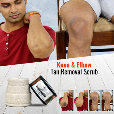 Knee and Elbow Tan Removal